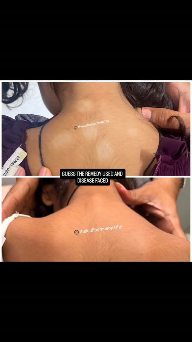 Post 6 by Dr.manan thekadi on Instagram (video)