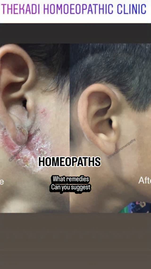 Post 3 by Dr.manan thekadi on Instagram (video)