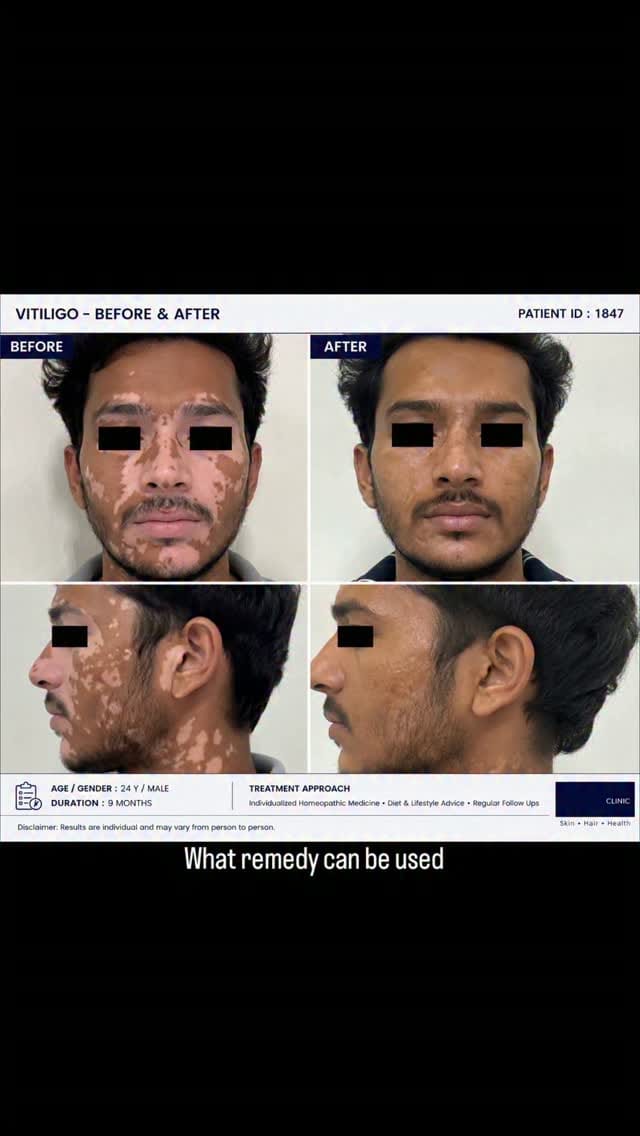 Post 2 by Dr.manan thekadi on Instagram (video)