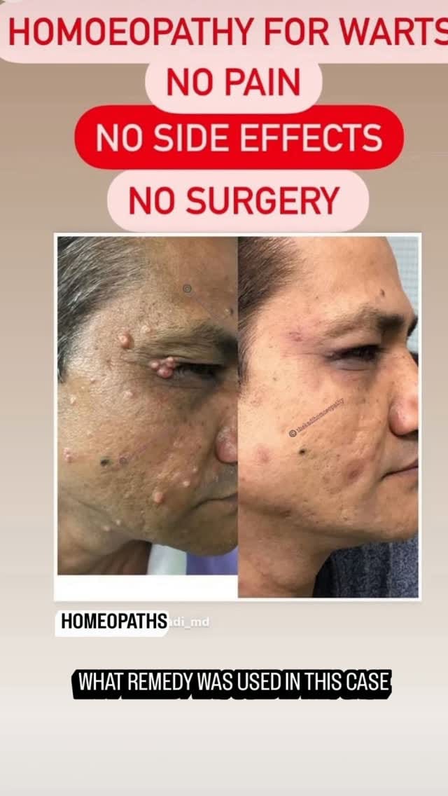 Post 4 by Dr.manan thekadi on Instagram (video)
