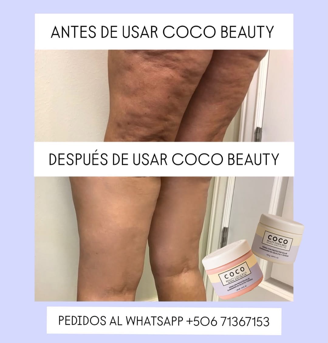 Post 1 by Coco Beauty Cr. on Instagram (image)