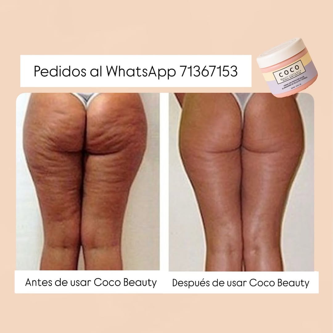 Post 6 by Coco Beauty Cr. on Instagram (image)