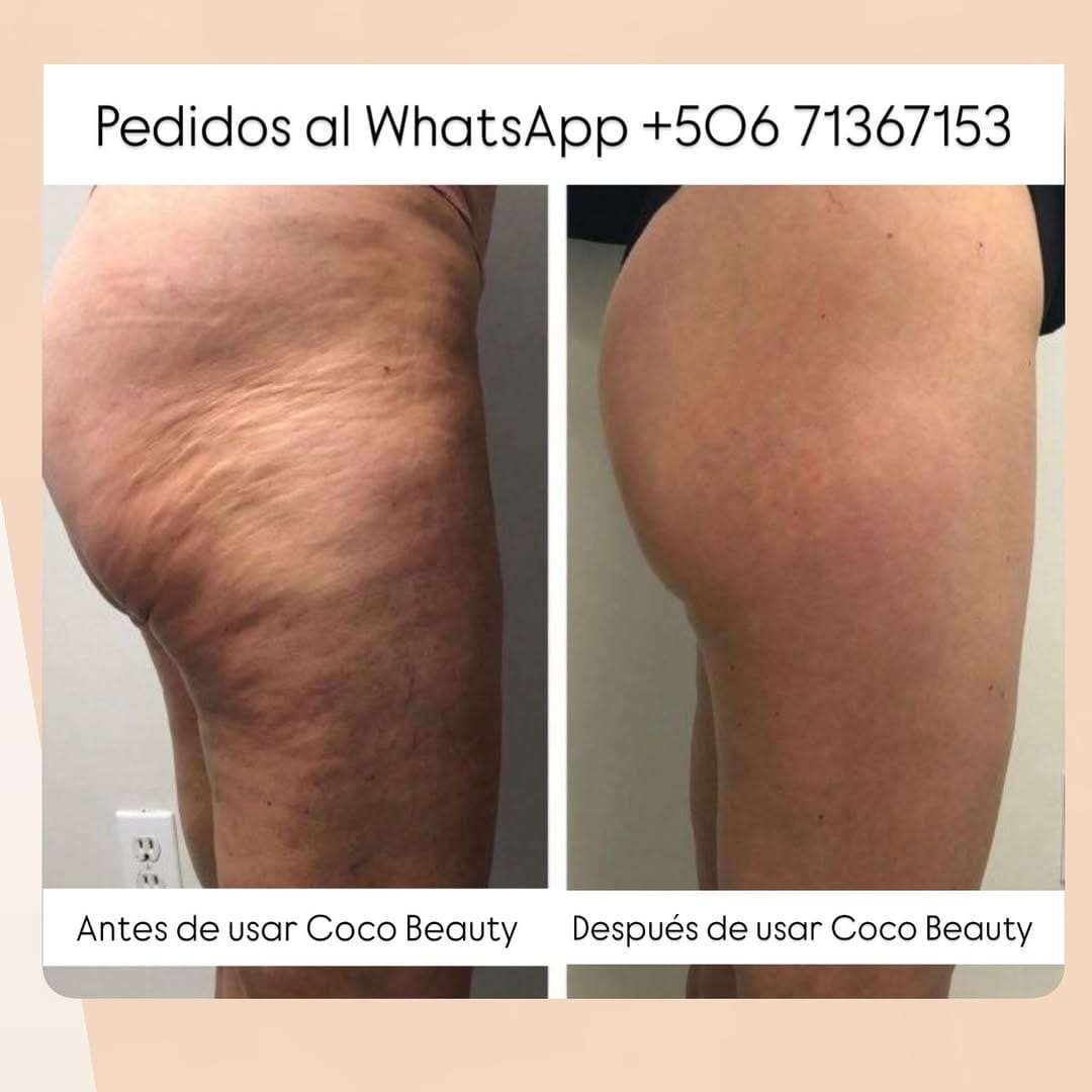Post 7 by Coco Beauty Cr. on Instagram (image)