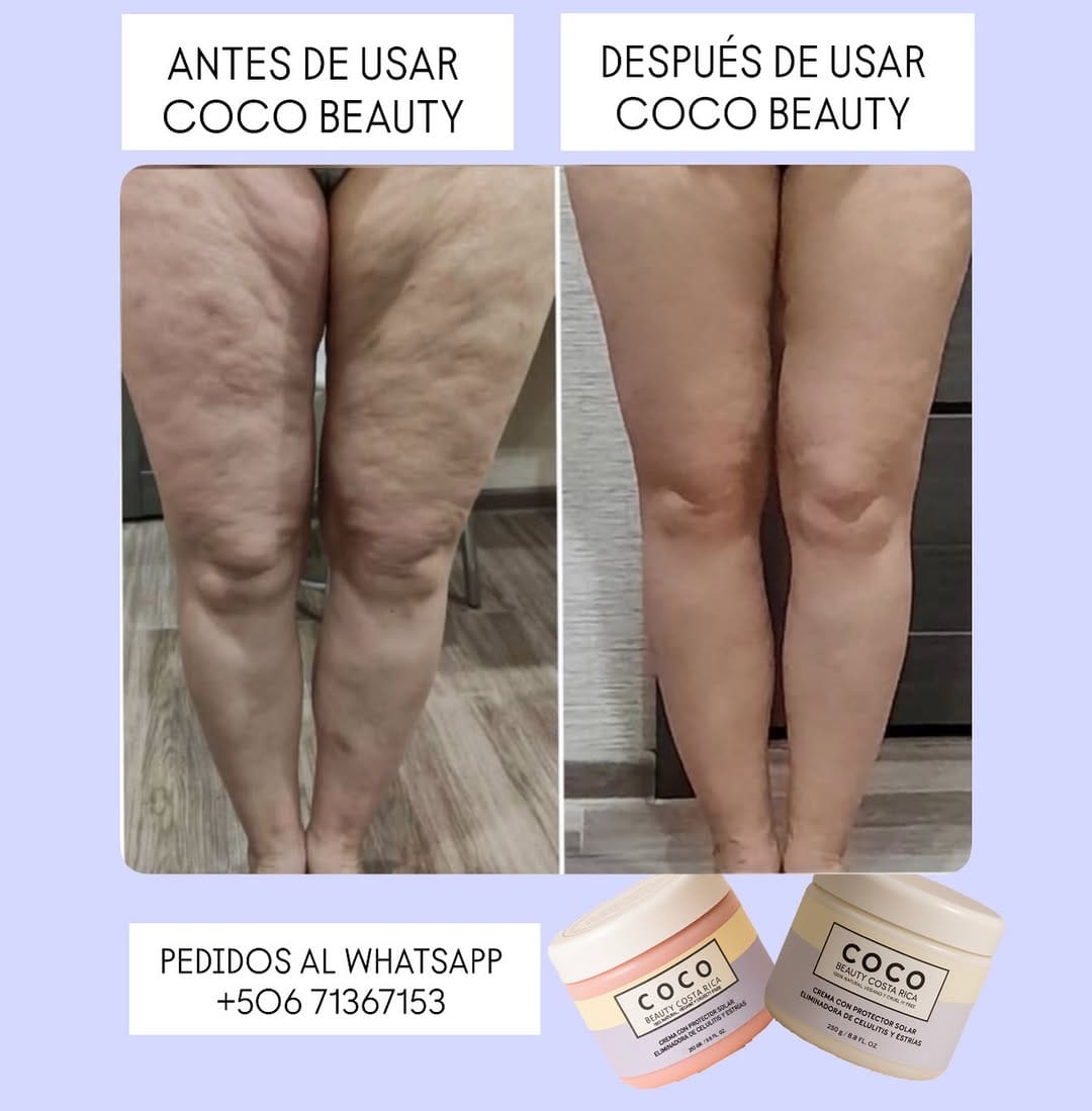 Post 2 by Coco Beauty Cr. on Instagram (image)