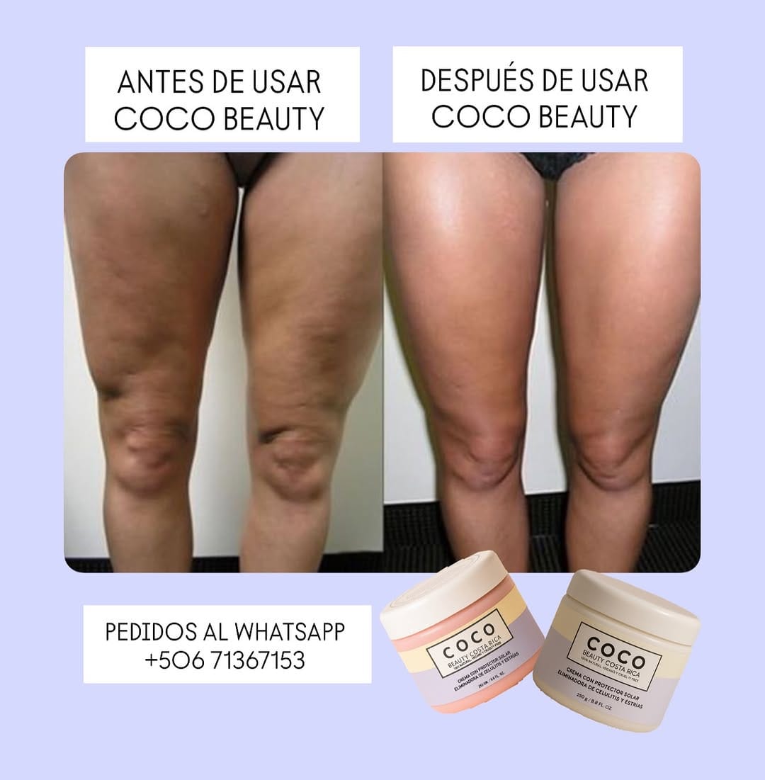 Post 4 by Coco Beauty Cr. on Instagram (image)