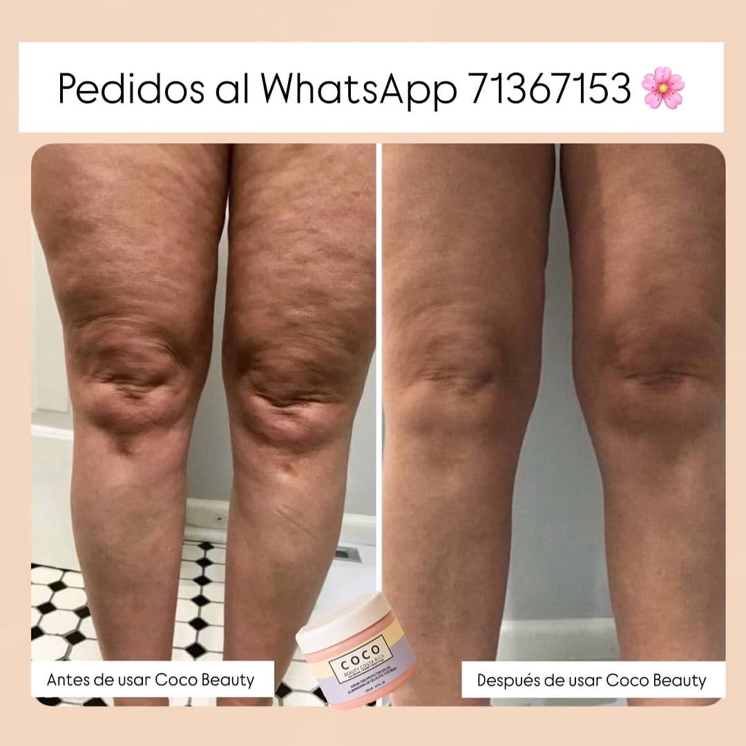 Post 8 by Coco Beauty Cr. on Instagram (image)