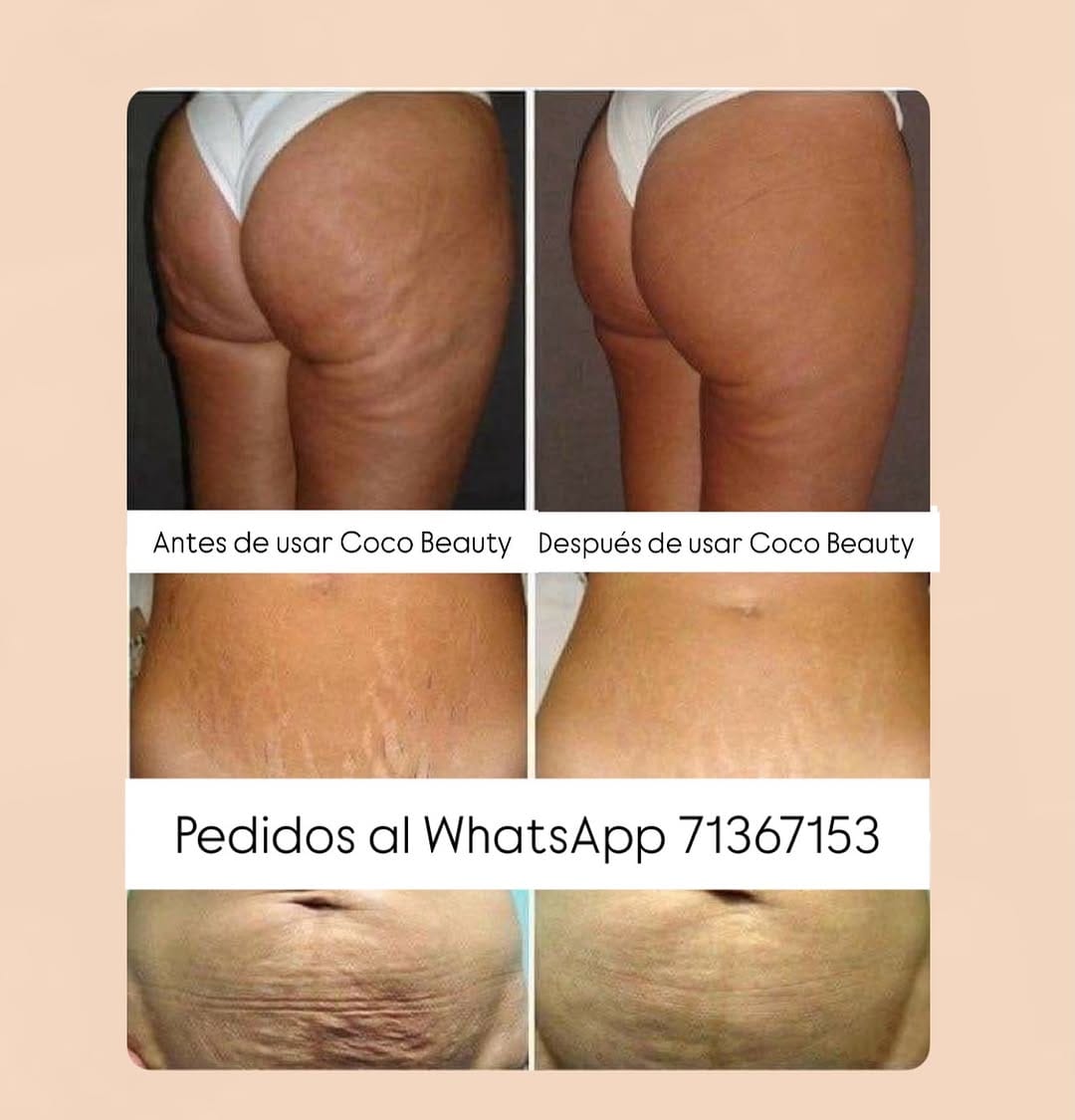 Post 5 by Coco Beauty Cr. on Instagram (image)