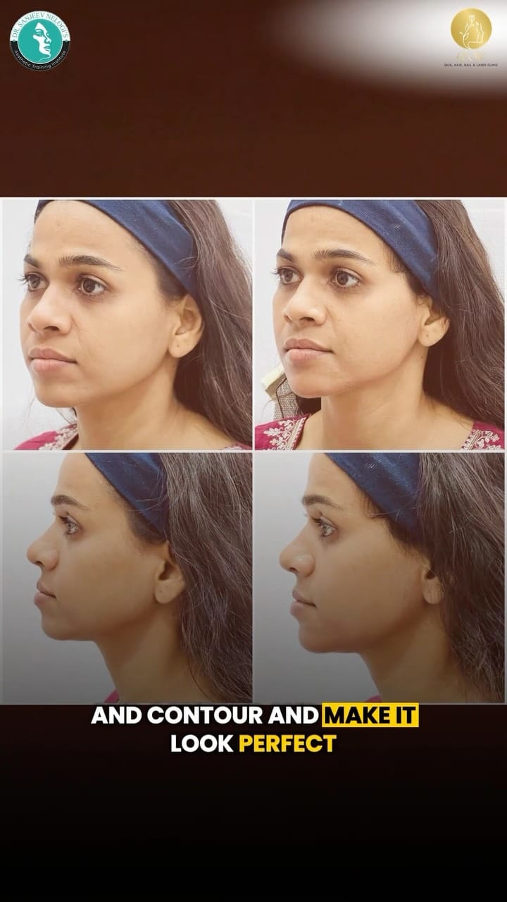 Post 3 by Sanjeev Nelogi on Instagram (video)