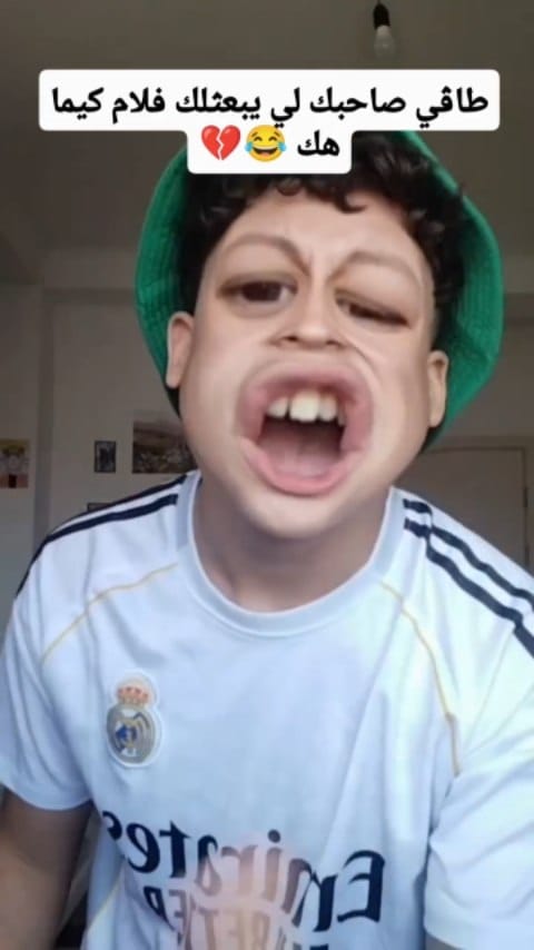 Post 2 by Anis Madani on Instagram (video)