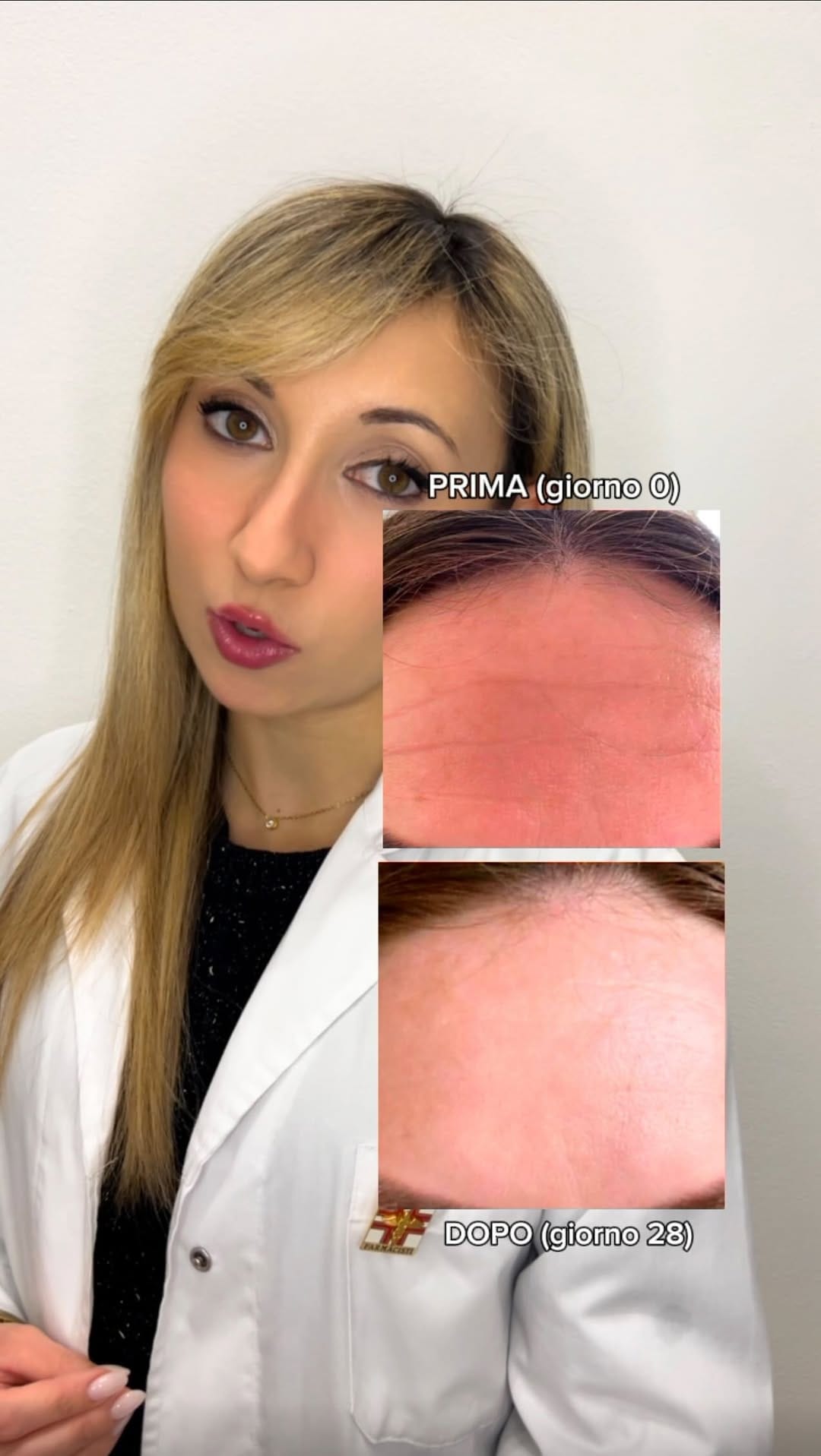 Post 8 by Dtt.ssa Serena Spizzirri | Farmacista Skin Expert on Instagram (video)