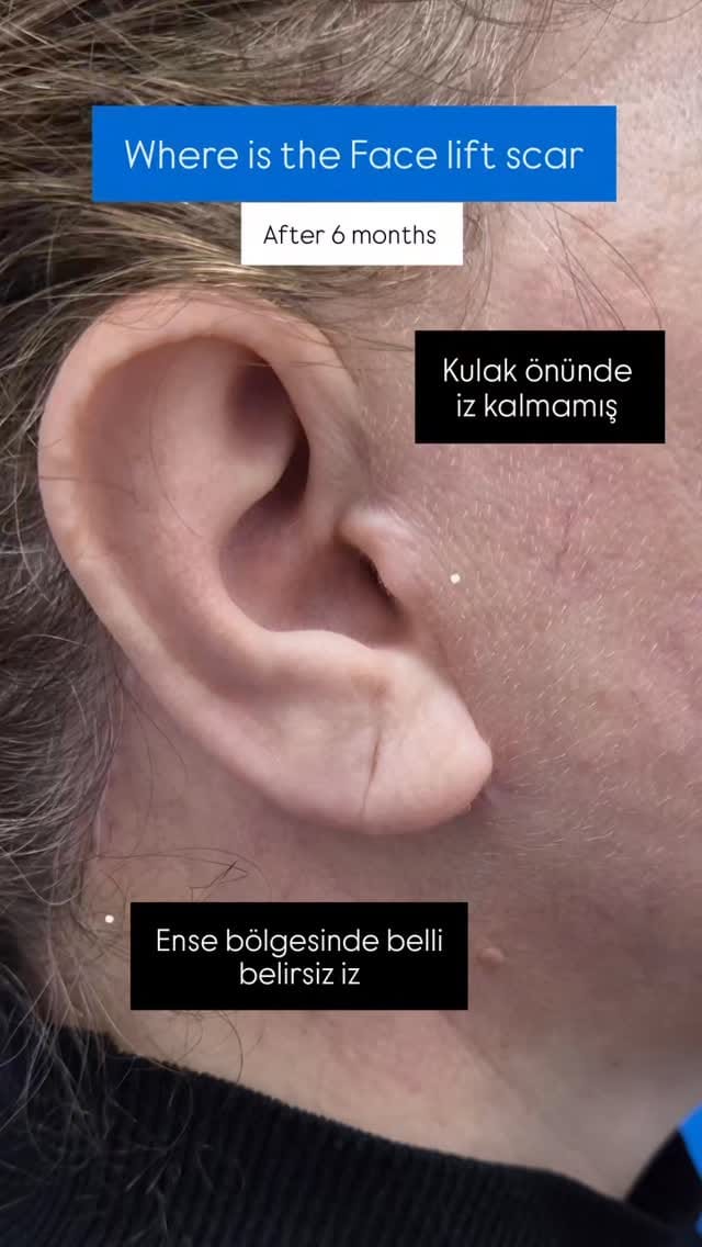Post 8 by Fırat Özer on Instagram (video)