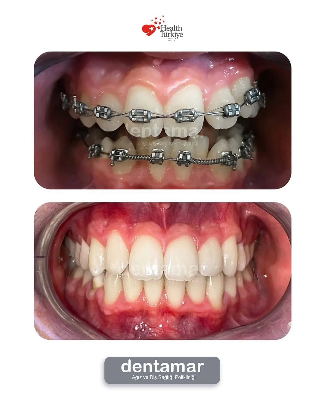 Post 5 by Dentamar Ağız ve Diş on Instagram (image)