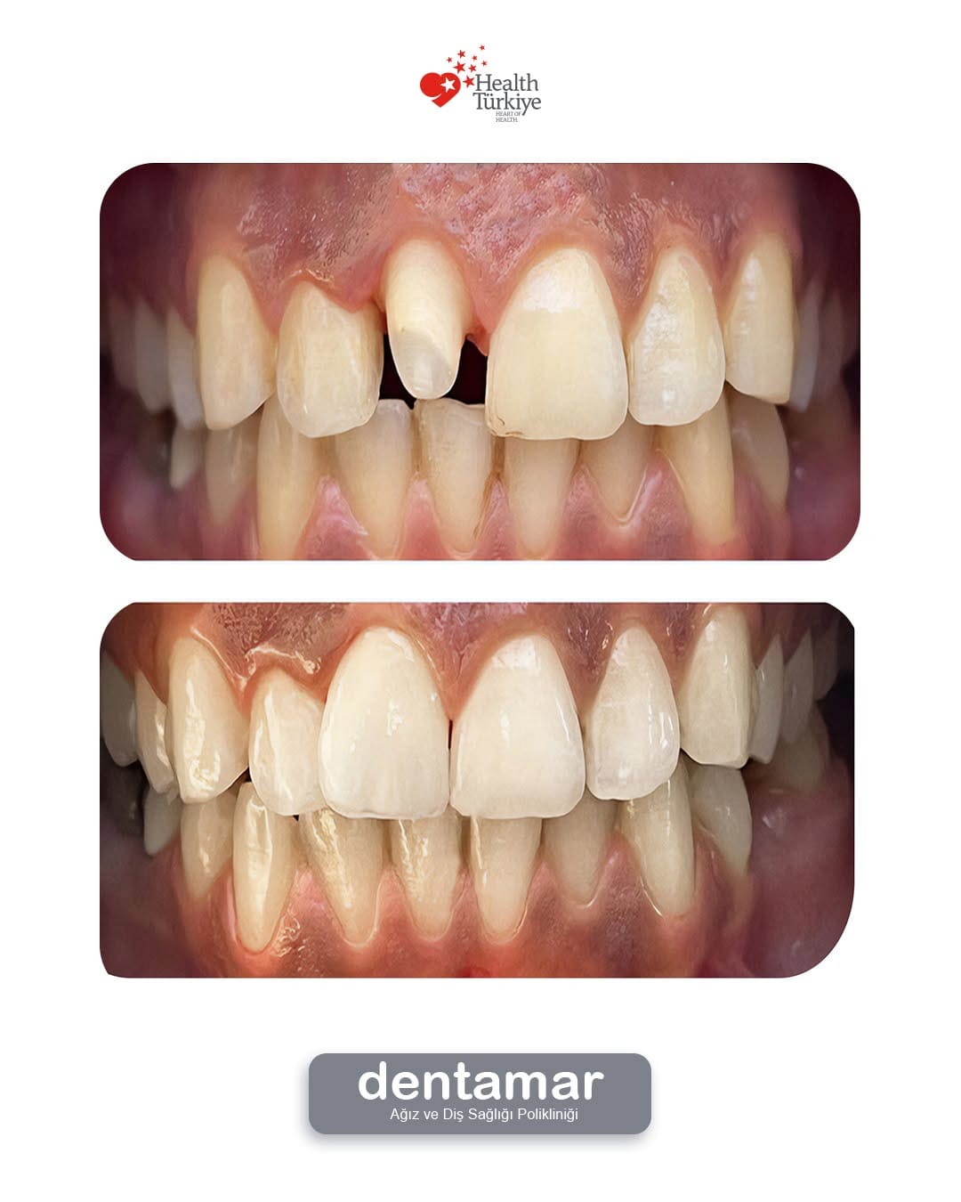 Post 9 by Dentamar Ağız ve Diş on Instagram (image)