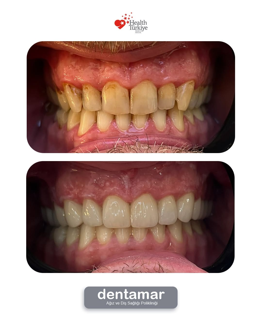 Post 3 by Dentamar Ağız ve Diş on Instagram (image)