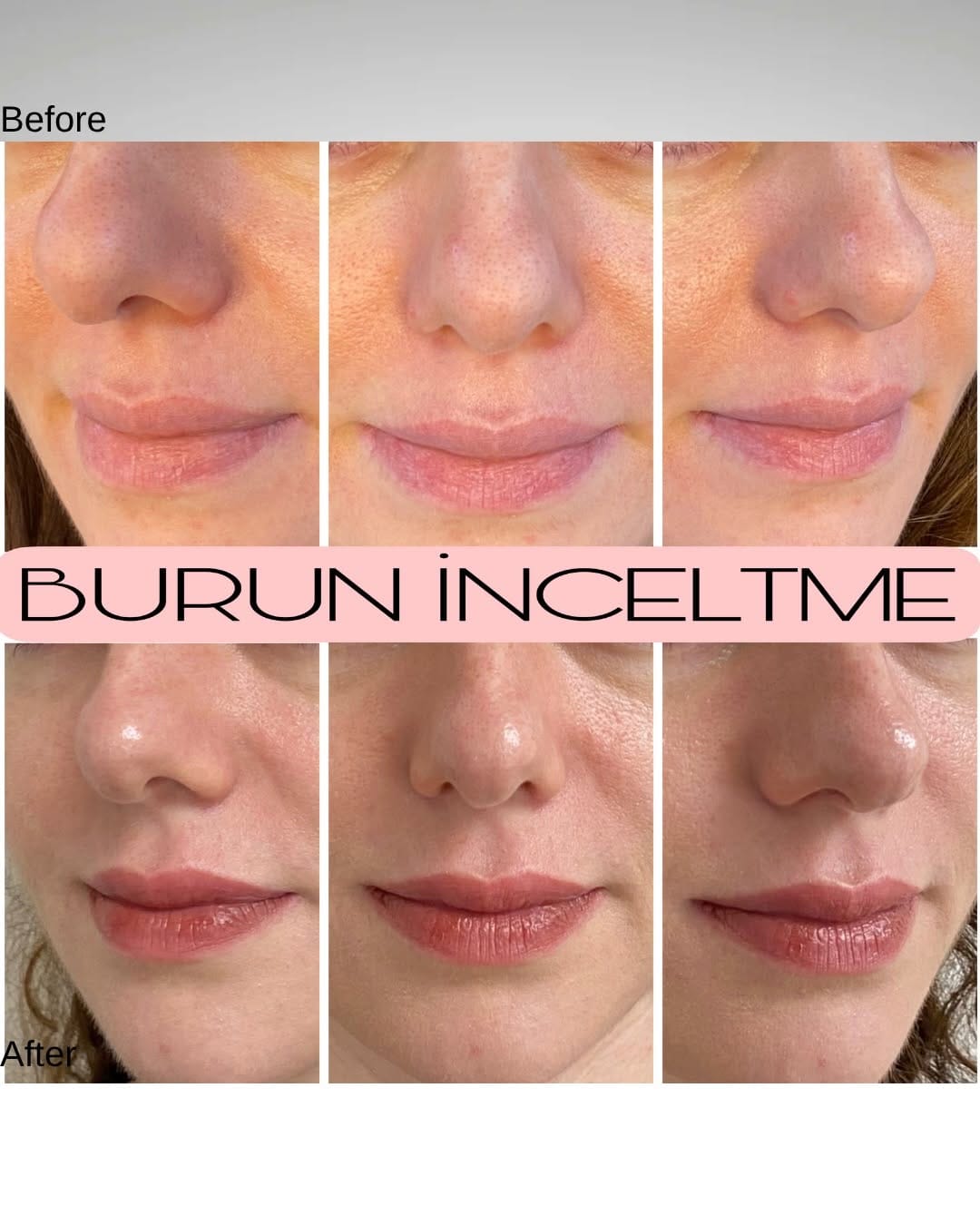 Post 6 by Dr. Ayçim Şen on Instagram (carousel)
