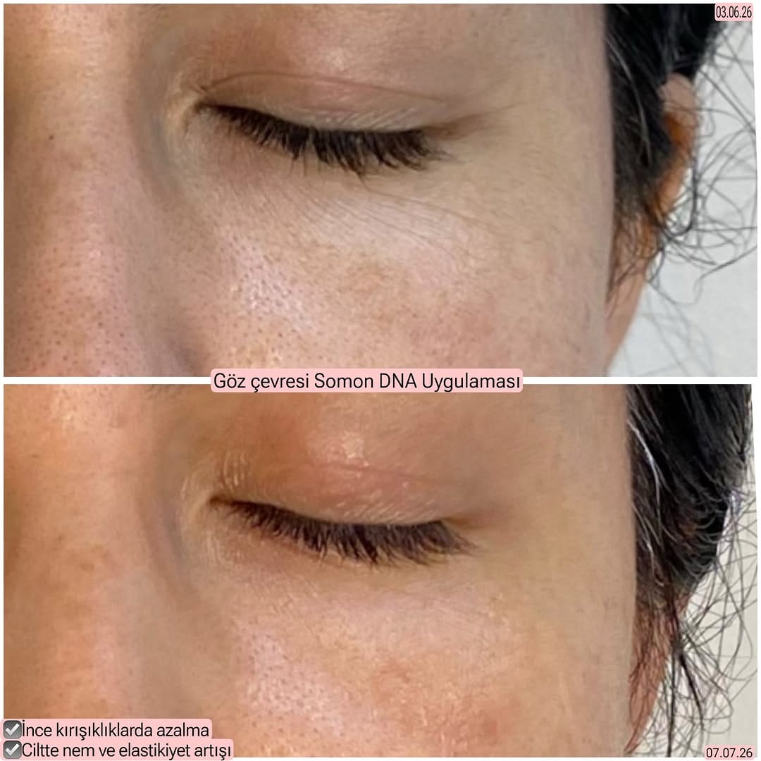 Post 4 by Dr. Ayçim Şen on Instagram (image)