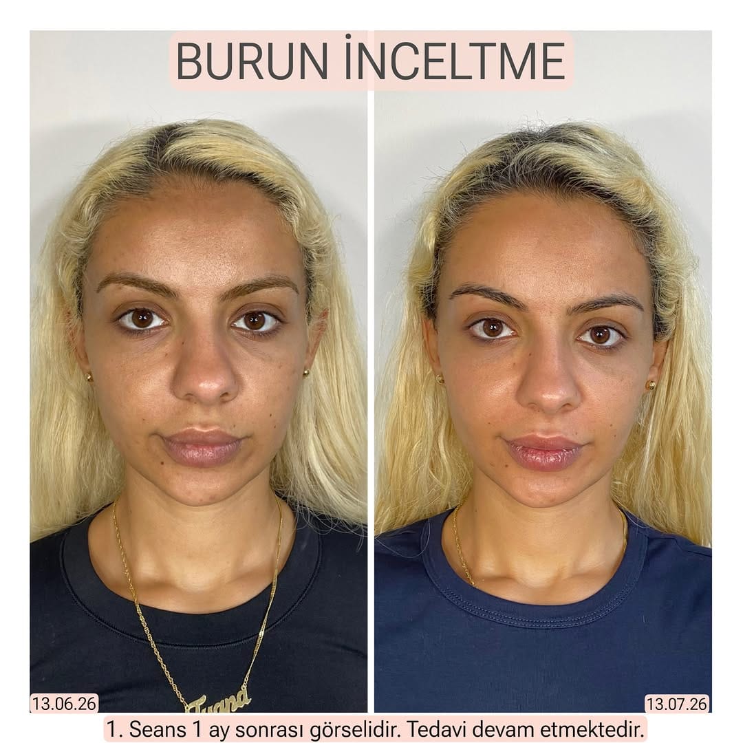 Post 2 by Dr. Ayçim Şen on Instagram (carousel)