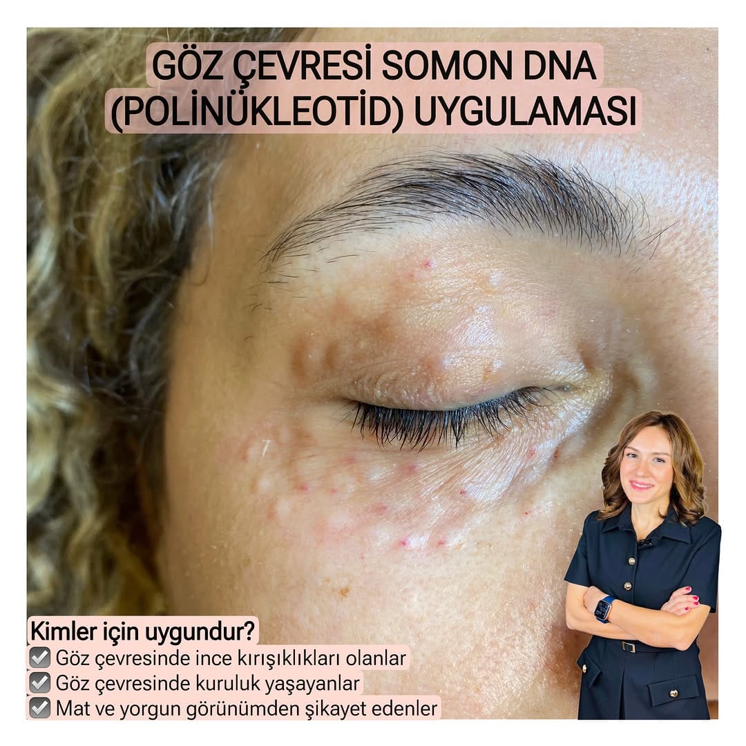 Post 3 by Dr. Ayçim Şen on Instagram (image)