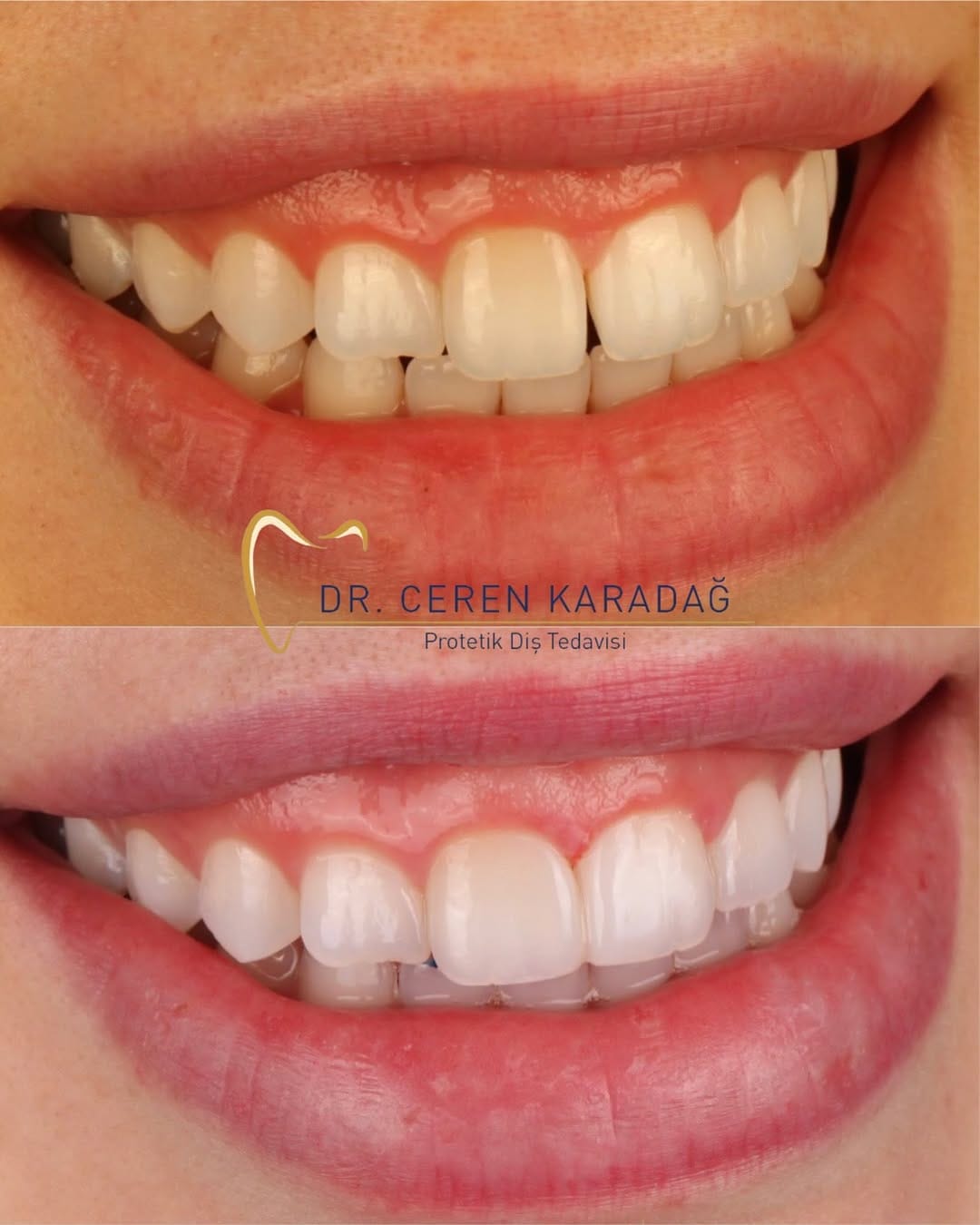 Post 3 by Uzm. Dr. Ceren Karadağ on Instagram (image)