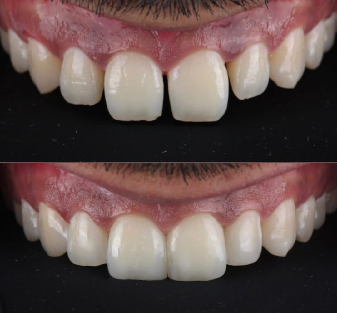 Post 10 by Uzm. Dr. Ceren Karadağ on Instagram (image)