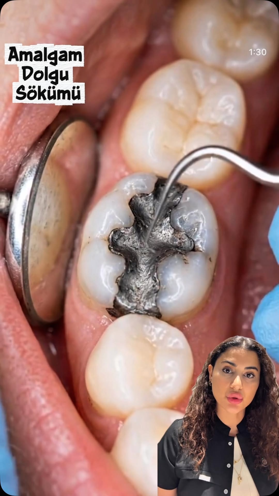 Post 4 by Uzm. Dr. Ceren Karadağ on Instagram (video)