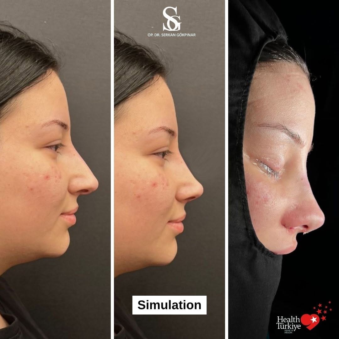 Post 8 by Op. Dr. Serkan Gökpınar | ENT Surgeon on Instagram (image)