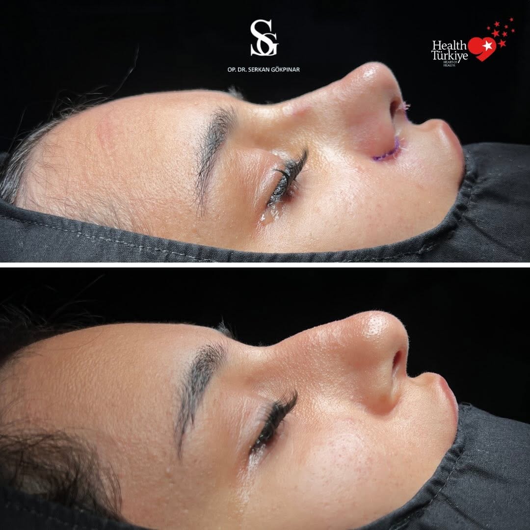 Post 4 by Op. Dr. Serkan Gökpınar | ENT Surgeon on Instagram (image)