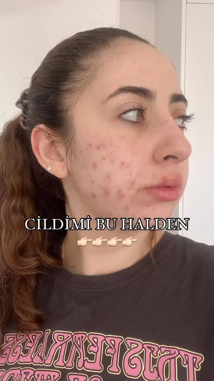 Post 9 by Eczacı Şerife Ademoğulları on Instagram (video)