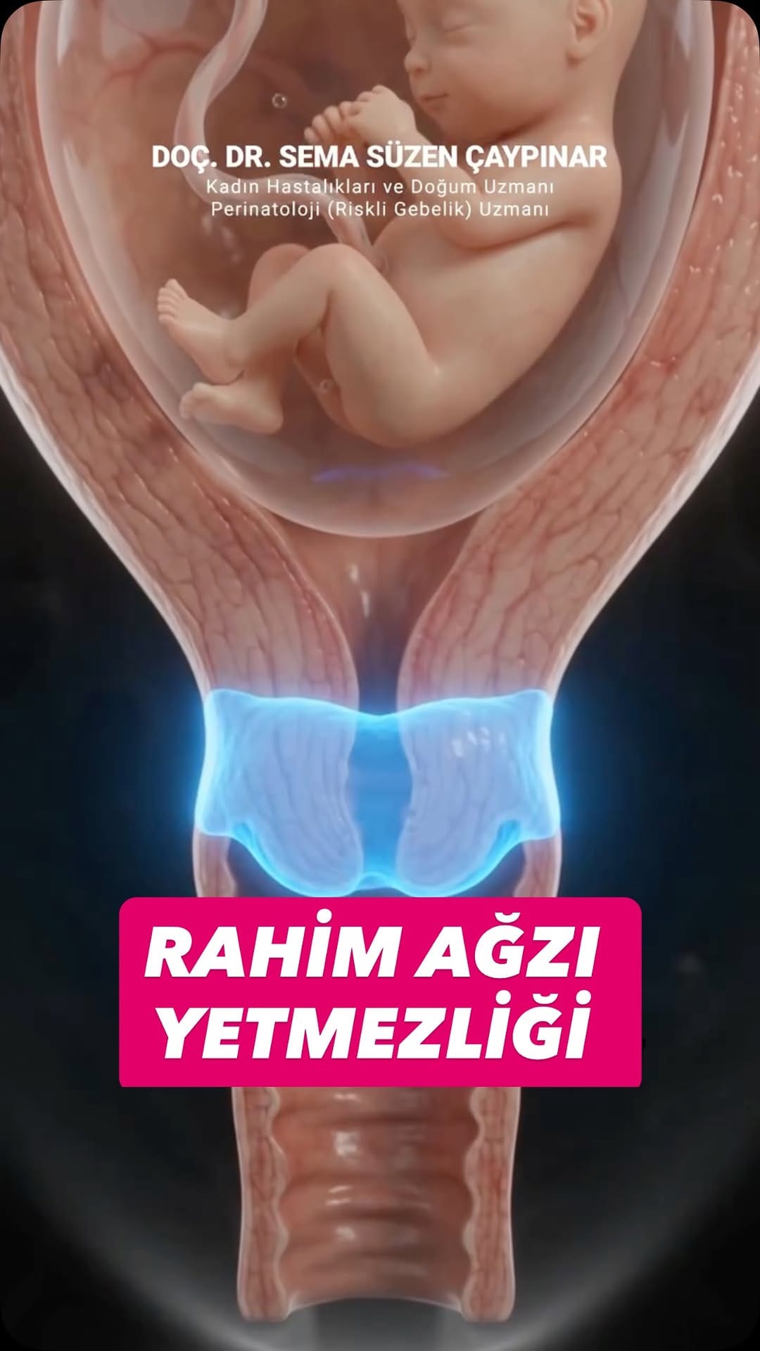 Post 3 by Doç.Dr.Sema Süzen Çaypınar on Instagram (video)