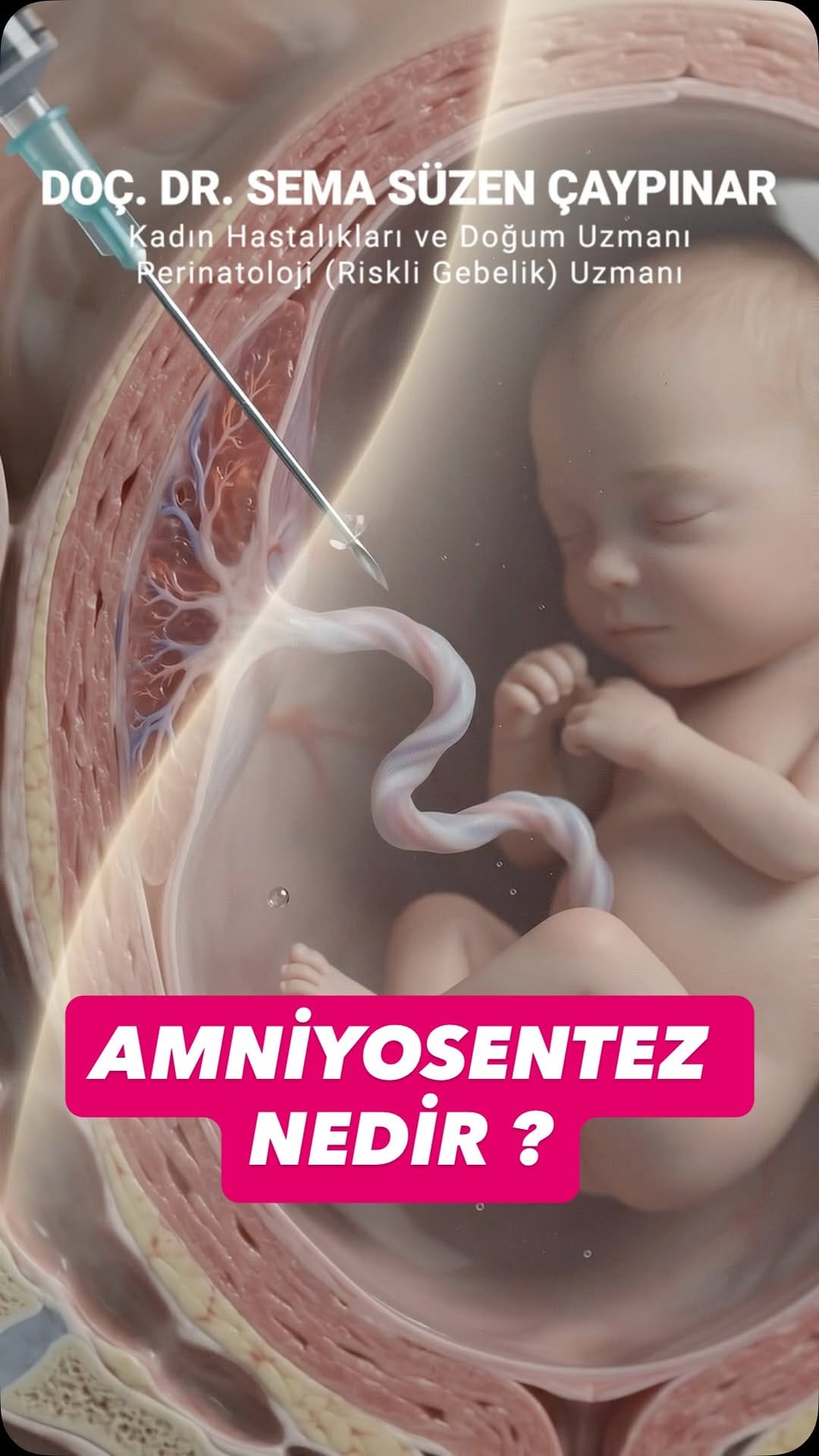 Post 2 by Doç.Dr.Sema Süzen Çaypınar on Instagram (video)