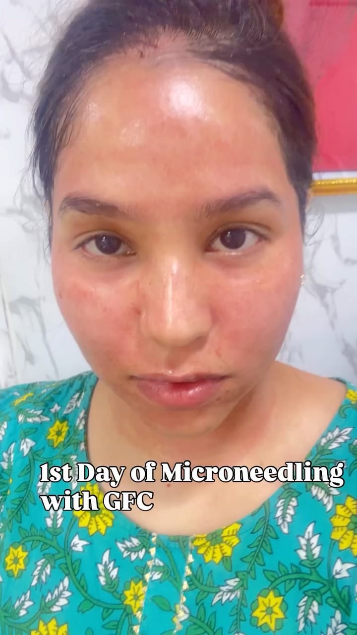 Post 9 by Dr Manisha Dubey on Instagram (video)