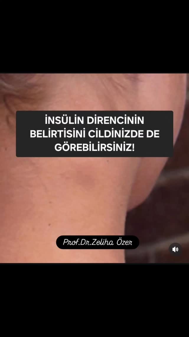 Post 5 by saglik.olsun🩵ÖZSÜMER SAĞLIK ÜRÜNLERİ LTD ŞTİ. on Instagram (video)