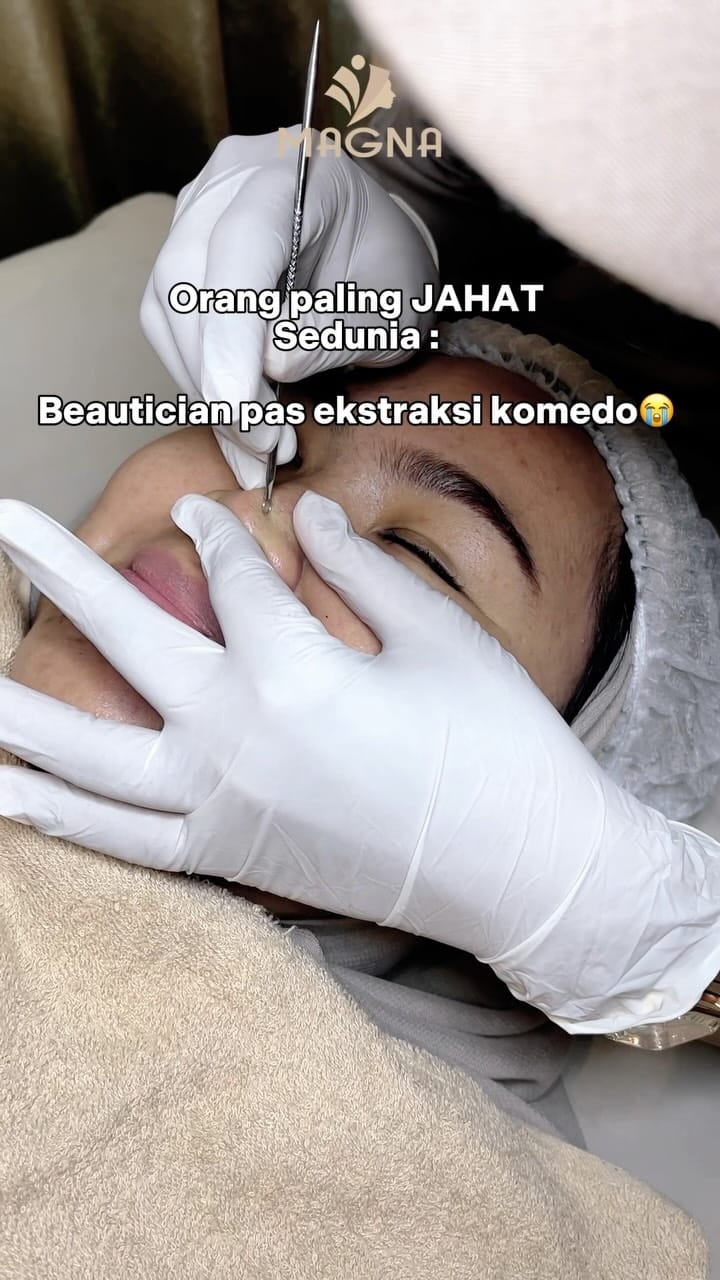 Post 4 by Klinik Kecantikan Magna on Instagram (video)