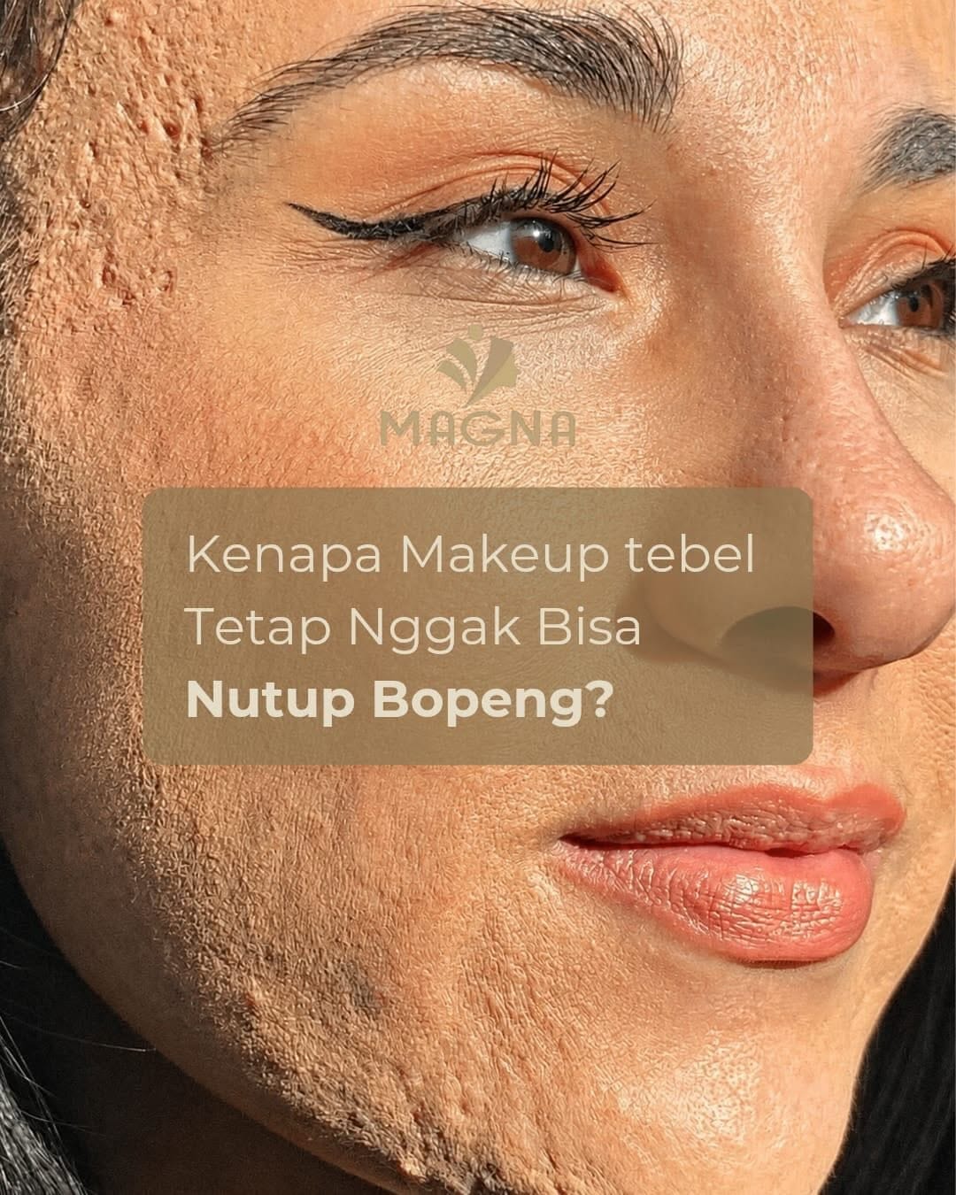 Post 3 by Klinik Kecantikan Magna on Instagram (carousel)