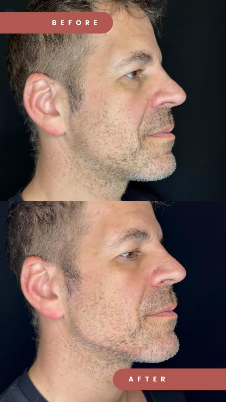 Post 10 by Dr. Renato Bortolotti on Instagram (video)