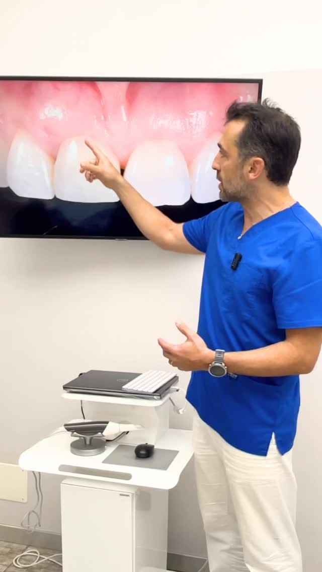 Post 2 by Studio Segantini odontoiatria e protesi dentaria - Genova on Instagram (video)