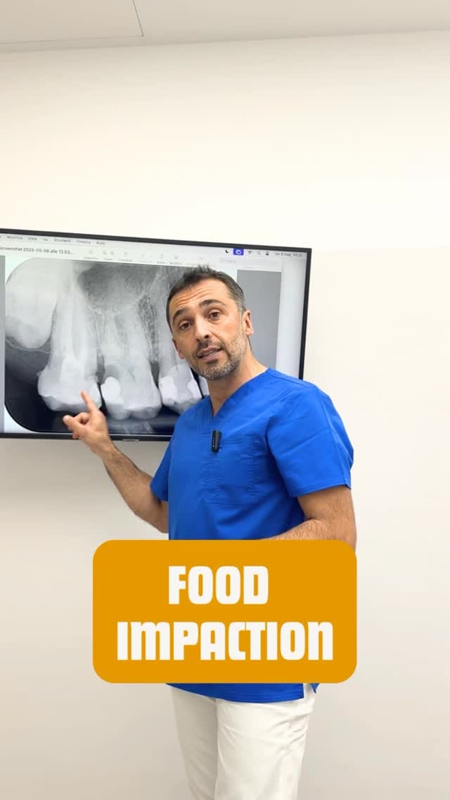 Post 3 by Studio Segantini odontoiatria e protesi dentaria - Genova on Instagram (video)