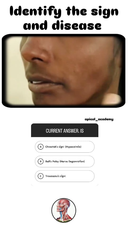 Post 8 by 𝗧𝗵𝗲_𝗺𝗲𝗱𝗶𝗰𝗮𝗹𝘀𝗶𝗺𝗽𝗹𝗶𝗳𝗶𝗲𝗱 on Instagram (video)