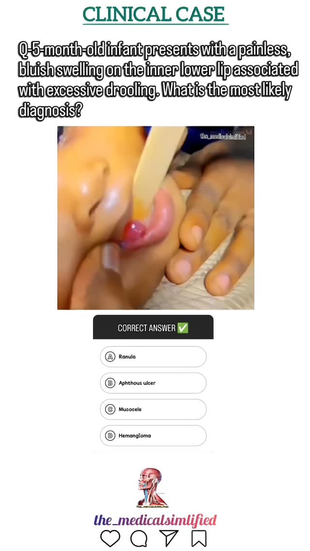 Post 5 by 𝗧𝗵𝗲_𝗺𝗲𝗱𝗶𝗰𝗮𝗹𝘀𝗶𝗺𝗽𝗹𝗶𝗳𝗶𝗲𝗱 on Instagram (video)