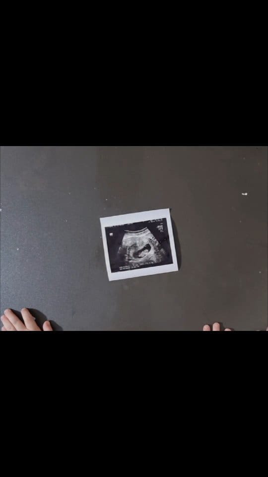 Post 3 by D’Alise Rosalba Nutrizionista on Instagram (video)