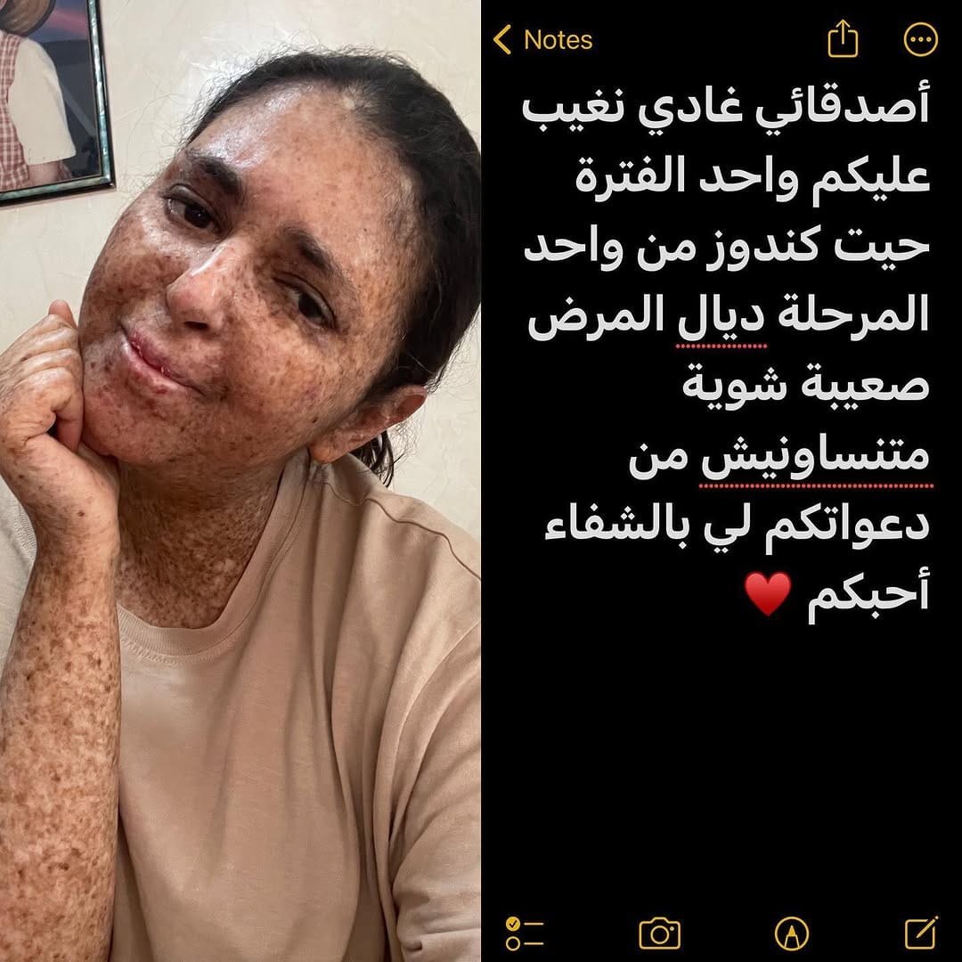Post 5 by Fatima ezzahra ghazaoui | فاطمة الزهراء غزاوي on Instagram (image)