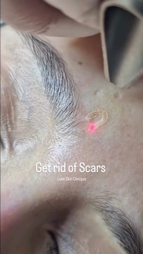 Post 4 by Luxe Clinique on Instagram (video)