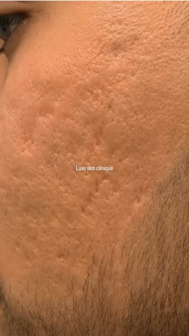 Post 3 by Luxe Clinique on Instagram (video)