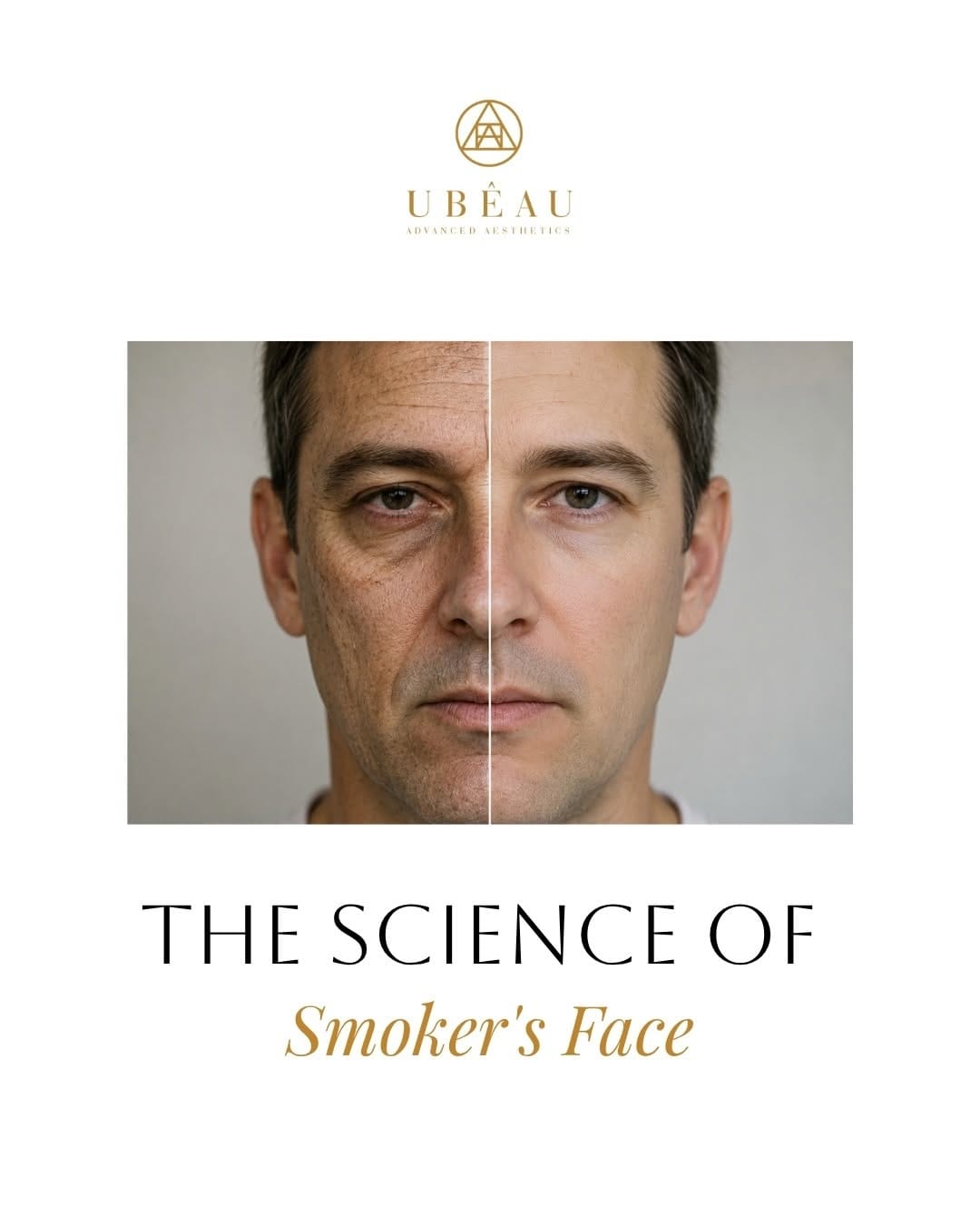 Post 10 by Ubêau Advanced Aesthetics on Instagram (carousel)