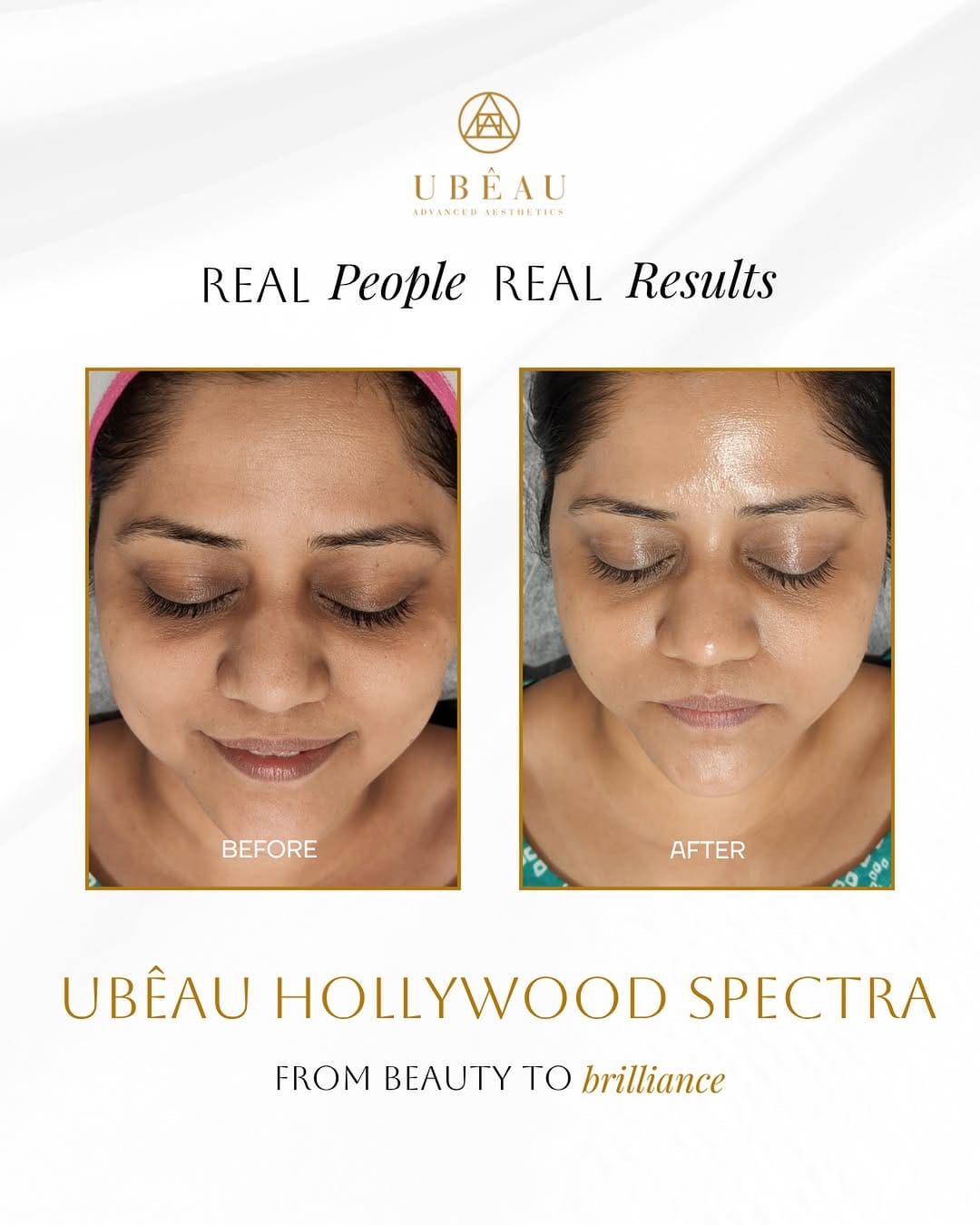 Post 2 by Ubêau Advanced Aesthetics on Instagram (image)