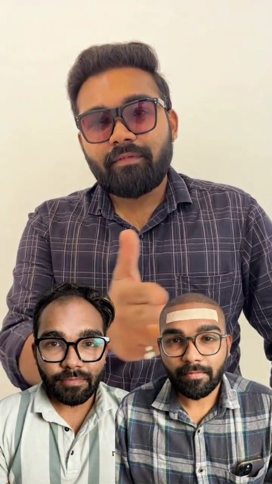 Post 10 by Clion Hair Transplant on Instagram (video)