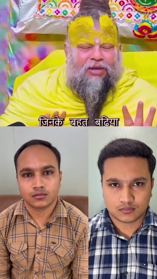 Post 9 by Clion Hair Transplant on Instagram (video)