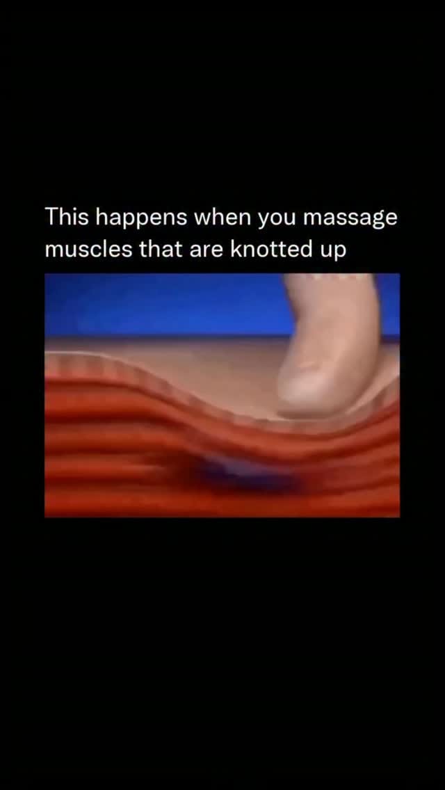 Post 7 by Dr Sidney | Orthopaedic Surgeon on Instagram (video)