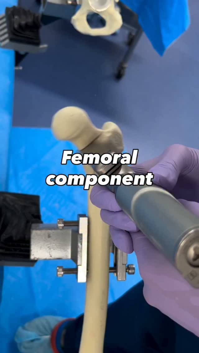 Post 5 by Dr Sidney | Orthopaedic Surgeon on Instagram (video)