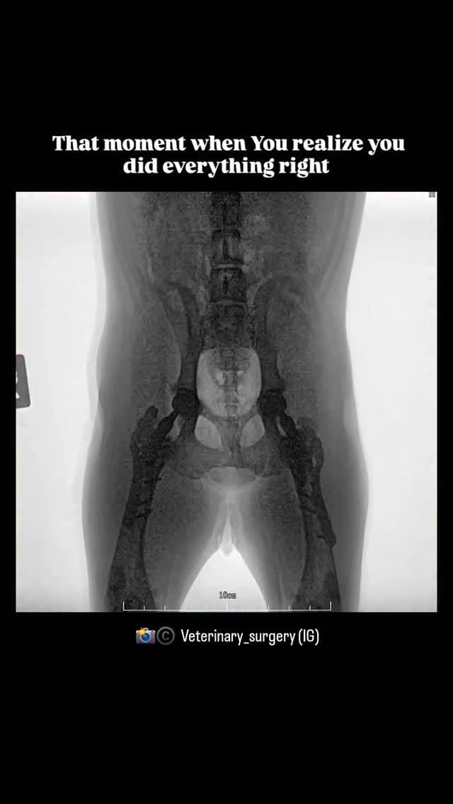 Post 9 by Dr Sidney | Orthopaedic Surgeon on Instagram (video)